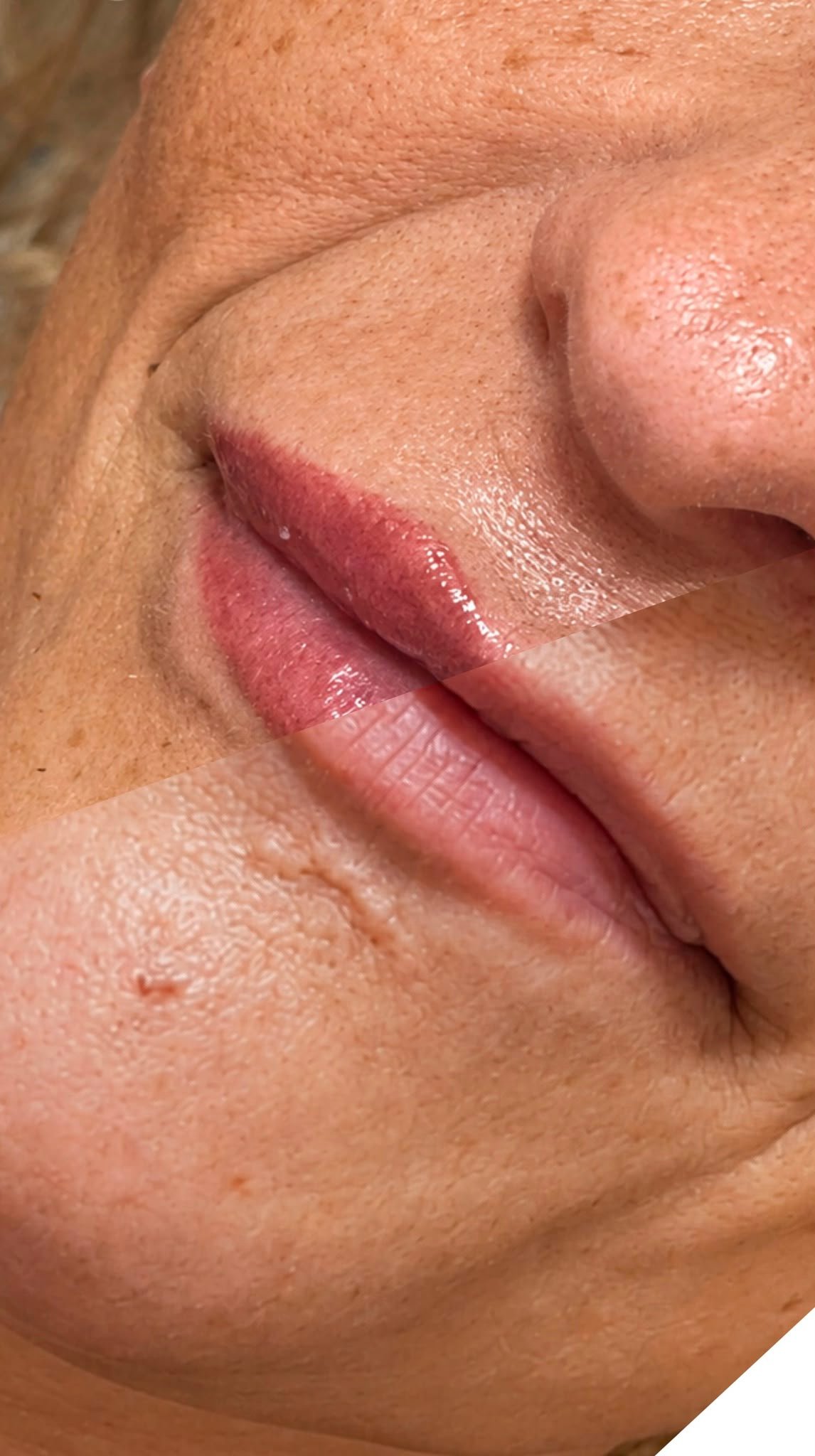 Evolución de la micropigmentación de labios una vez cicatrizada