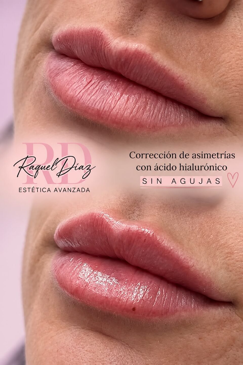 Raquel Diaz Estetica Avanzada
