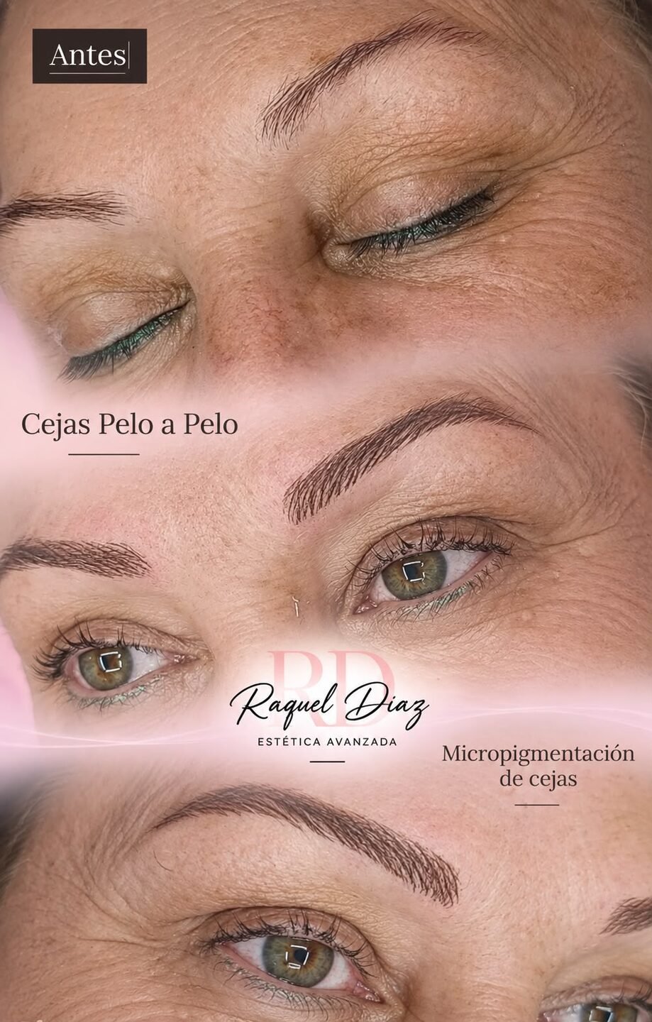 Raquel Diaz Estetica Avanzada