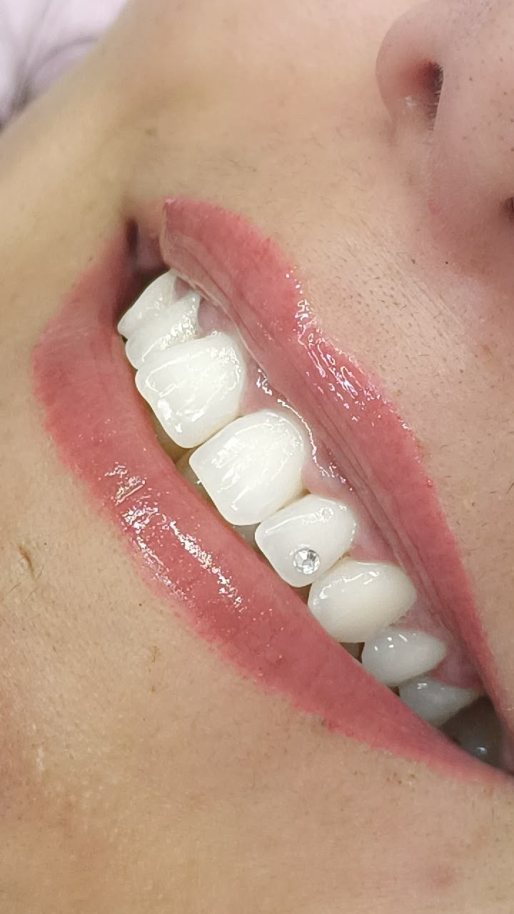 Sonrisa con tooth gem